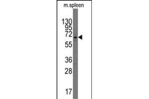Western blot analysis of anti-RP3 b (ABIN390264 and ABIN2850544) in mouse spleen tissue lysates (35 μg/lane).
