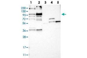 Western blot analysis of Lane 1: RT-4, Lane 2: U-251 MG, Lane 3: Human Plasma, Lane 4: Liver, Lane 5: Tonsil with LRCH2 polyclonal antibody  at 1:250-1:500 dilution. (LRCH2 anticorps)