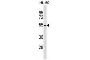 MGAT3 Antibody (C-term) western blot analysis in HL-60 cell line lysates (35µg/lane). (MGAT3 anticorps  (C-Term))