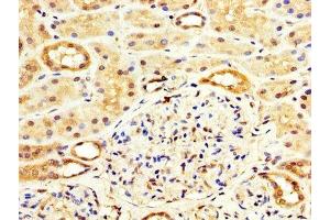 IHC image of ABIN7175838 diluted at 1:100 and staining in paraffin-embedded human kidney tissue performed on a Leica BondTM system.