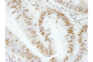 Immunohistochemistry (IHC) image for anti-RNA Binding Motif Protein 25 (RBM25) (AA 475-525) antibody (ABIN7448762) (RBM25 anticorps  (AA 475-525))