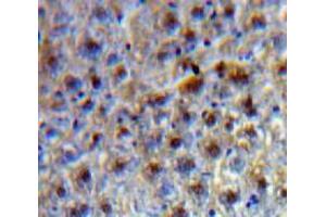 IHC-P analysis of Liver tissue, with DAB staining. (TCF20 anticorps  (AA 125-213))