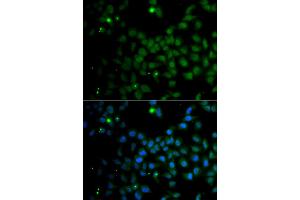 Immunofluorescence analysis of A549 cells using SMAD9 antibody.