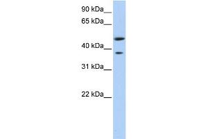 WB Suggested Anti-MAGEA3 Antibody Titration:  0. (MAGEA3 anticorps  (Middle Region))