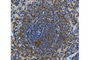 IHC analysis of TLR1 using anti-TLR1 antibody (ABIN7602194). (TLR1 anticorps  (AA 62-404))