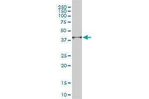 PSMD14 monoclonal antibody (M01), clone 4A10-E8 Western Blot analysis of PSMD14 expression in A-431 .