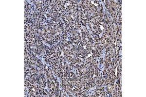 IHC analysis of SAE1 using anti-SAE1 antibody (ABIN7601346). (SAE1 anticorps  (AA 33-299))