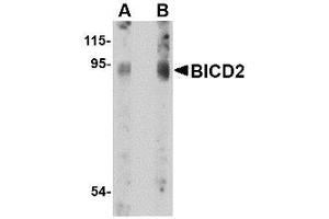 Image no. 1 for anti-Bicaudal D Homolog 2 (BICD2) (C-Term) antibody (ABIN342679) (BICD2 anticorps  (C-Term))