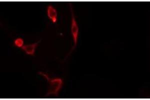 ABIN6276298 staining  Hela cells by IF/ICC.