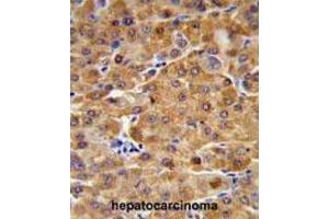 Immunohistochemistry (IHC) image for anti-Cystathionine-beta-Synthase (CBS) antibody (ABIN3002903)