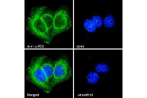 (ABIN5539622) Immunofluorescence analysis of paraformaldehyde fixed MCF7 cells, permeabilized with 0. (c-FOS anticorps  (AA 283-295))