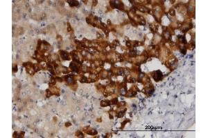 Immunoperoxidase of monoclonal antibody to SRC on formalin-fixed paraffin-embedded human liver.