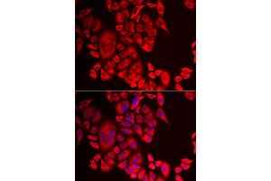Immunofluorescence analysis of MCF-7 cells using QPCT antibody (ABIN5974054). (QPCT anticorps)