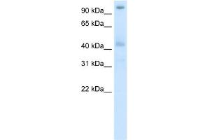 WB Suggested Anti-POGZ Antibody Titration:  5. (POGZ anticorps  (N-Term))