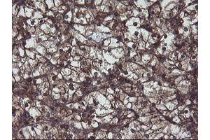 Image no. 2 for anti-Prefoldin Subunit 3 (PFDN3) antibody (ABIN1501706)