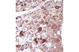 Image no. 2 for anti-phosphoenolpyruvate Carboxykinase 1 (Soluble) (PCK1) (N-Term) antibody (ABIN360565) (PCK1 anticorps  (N-Term))