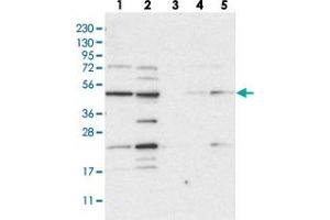 Western blot analysis of Lane 1: RT-4, Lane 2: U-251 MG, Lane 3: Human Plasma, Lane 4: Liver, Lane 5: Tonsil with NAPEPLD polyclonal antibody  at 1:250-1:500 dilution. (NAPEPLD anticorps)