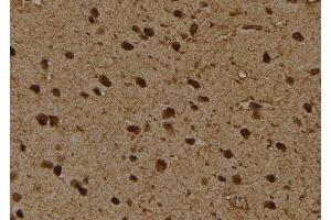 ABIN6276475 at 1/100 staining Rat brain tissue by IHC-P.
