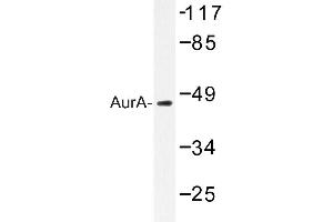 Image no. 1 for anti-Aurora Kinase A (AURKA) antibody (ABIN272125) (Aurora A anticorps)