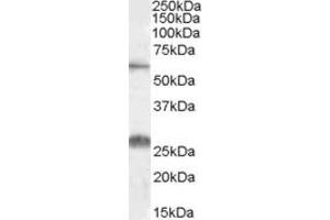 Western Blotting (WB) image for anti-Solute Carrier Family 47, Member 1 (SLC47A1) (AA 528-541) antibody (ABIN490521)