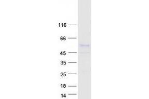Validation with Western Blot