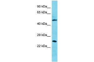 Host: Rabbit Target Name: C3orf26 Sample Type: 721_B Whole Cell lysates Antibody Dilution: 1. (CMSS1 anticorps  (N-Term))