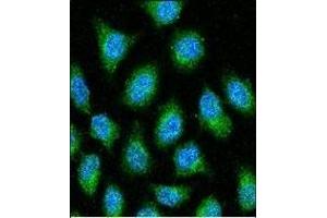 GDH Antibody (N-term) 7873a confocal immunofluorescent analysis with Hela cell. (GAPDH anticorps  (N-Term))