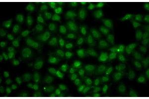 Immunofluorescence analysis of A549 cells using USP26 Polyclonal Antibody (USP26 anticorps)