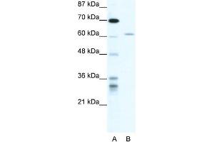 Human HepG2; WB Suggested Anti-ZNFN1A4 Antibody Titration: 1. (IKZF4 anticorps  (N-Term))