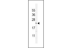 UTS2 Antibody (N-term) (ABIN392523 and ABIN2842080) western blot analysis in WiDr cell line lysates (35 μg/lane). (Urotensin 2 anticorps  (N-Term))