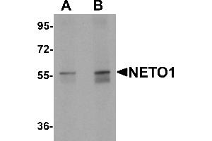 Western blot analysis of NETO1 in human lung tissue lysate with NETO1 antibody at (A) 1 and (B) 2 µg/mL.