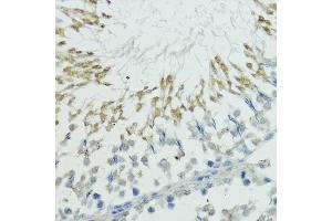 Immunohistochemistry of paraffin-embedded rat testis using TRIP12 antibody (ABIN6129753, ABIN6149543, ABIN6149544 and ABIN6225295) at dilution of 1:100 (40x lens). (TRIP12 anticorps  (AA 1-240))