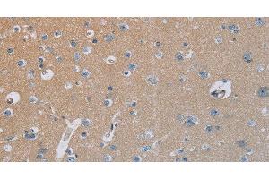 Immunohistochemistry of paraffin-embedded Human brain tissue using HSD3B7 Polyclonal Antibody at dilution 1:40