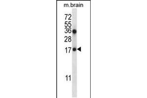 Western blot analysis in mouse brain tissue lysates (35ug/lane). (COPZ1 anticorps  (N-Term))