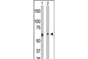 Antibody is used in Western blot to detect CERK in mouse heart tissue lysate (Lane 1) and A2058 cell lysate (Lane 2). (CERK anticorps  (C-Term))