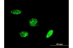 Immunofluorescence of monoclonal antibody to PAX8 on HeLa cell. (PAX8 anticorps  (AA 1-450))