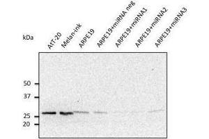 Anti. (RAB27A anticorps  (C-Term))