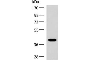 Western blot analysis of HepG2 cell lysate using PLPPR5 Polyclonal Antibody at dilution of 1:1500 (LPPR5 anticorps)