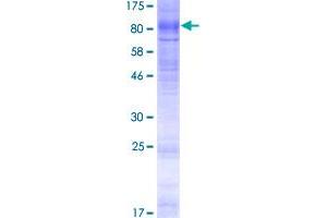 Image no. 1 for Phosphatidylinositol Glycan Anchor Biosynthesis, Class Z (PIGZ) (AA 1-579) protein (GST tag) (ABIN1315055)