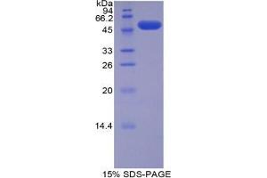 SDS-PAGE analysis of Mouse FATP5 Protein. (SLC27A5 Protéine)