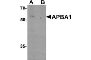 Western blot analysis of APBA1 in rat brain tissue lysate with APBA1 Antibody  at 0. (APBA1 anticorps  (N-Term))