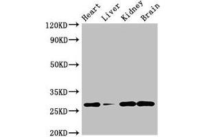 Western Blot Positive WB detected in: Mouse heart tissue, Mouse liver tissue, Mouse kidney tissue, Mouse brain tissue All lanes: GUCD1 antibody at 4 μg/mL Secondary Goat polyclonal to rabbit IgG at 1/50000 dilution Predicted band size: 28, 34 kDa Observed band size: 28 kDa (C22orf13 anticorps  (AA 1-136))