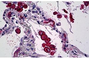 Human Lung, Macrophages: Formalin-Fixed, Paraffin-Embedded (FFPE)