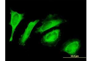 Immunofluorescence of purified MaxPab antibody to C14orf114 on HeLa cell. (EXD2 anticorps  (AA 1-496))