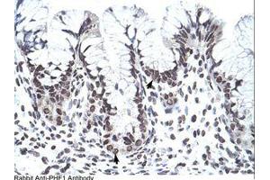 Image no. 1 for anti-PHD Finger Protein 1 (PHF1) (AA 421-470) antibody (ABIN202770)