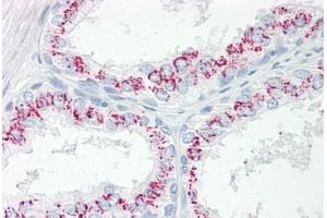 Image no. 2 for anti-Cytoplasmic Polyadenylation Element Binding Protein 3 (CPEB3) (AA 324-373) antibody (ABIN6749761) (CPEB3 anticorps  (AA 324-373))