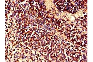 Immunohistochemistry of paraffin-embedded human spleen tissue using ABIN7158066 at dilution of 1:100 (LRRFIP1 anticorps  (AA 1-315))