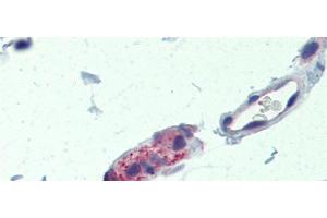 Rabbit Anti-TNKS Antibody  arp33755 Paraffin Embedded Tissue: Human Small Intestine Antibody Concentration: 5 ug/ml