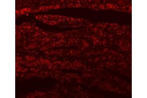 IF analysis of SF3A1 using anti-SF3A1 antibody (ABIN7600556). (SF3A1 anticorps  (AA 20-556))