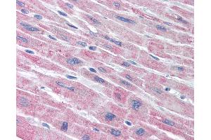 Anti-PLA2G5 antibody IHC of human heart.